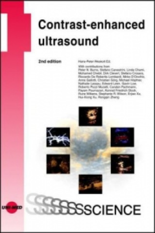 Könyv Contrast-enhanced ultrasound Hans-Peter Weskott