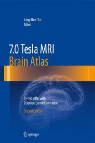 Könyv 7.0 Tesla MRI Brain Atlas Zang-Hee Cho