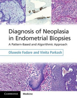 Knjiga Diagnosis of Neoplasia in Endometrial Biopsies Book and Online Bundle Oluwole Fadare