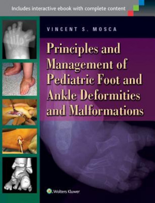 Könyv Principles and Management of Pediatric Foot and Ankle Deformities and Malformations Vincent Mosca