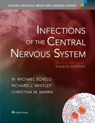 Książka Infections of the Central Nervous System W  Michael Scheld