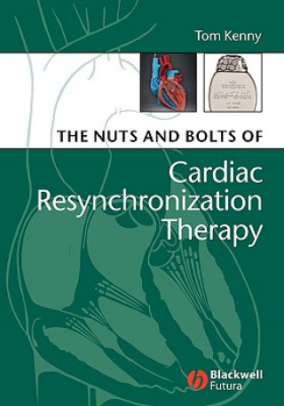 Kniha Nuts and Bolts of Cardiac Resynchronization Therapy Tom Kenny