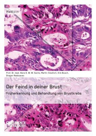 Livre Feind in deiner Brust. Fruherkennung und Behandlung von Brustkrebs Hans E. W. W. Sachs