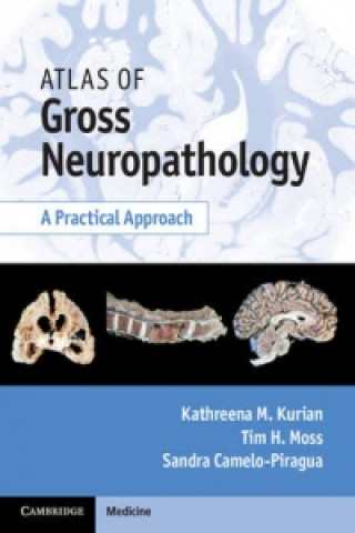 Carte Atlas of Gross Neuropathology Book and Online Bundle Kathreena M. Kurian