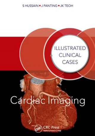 Carte Cardiac Imaging Shahid Hussain