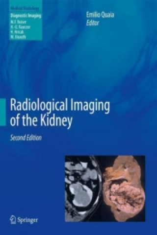 Kniha Radiological Imaging of the Kidney Emilio Quaia