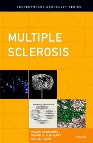 Book Multiple Sclerosis Moses Rodriguez