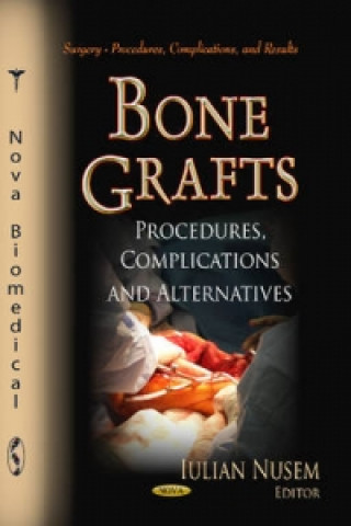 Buch Bone Grafts Iulian Nusem