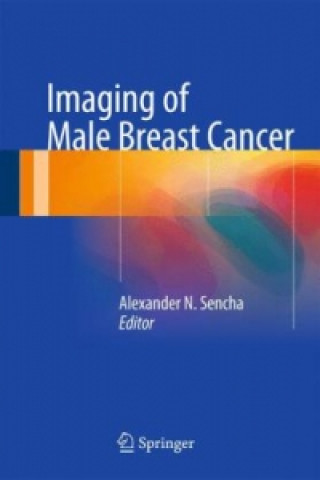 Kniha Imaging of Male Breast Cancer Alexander N. Sencha