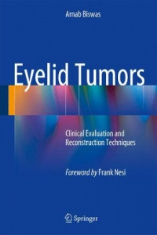 Kniha Eyelid Tumors Arnab Biswas