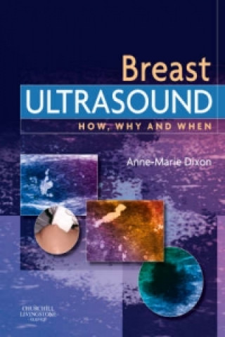 Kniha Breast Ultrasound Anne-Marie Dixon