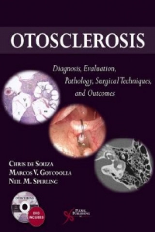 Könyv Otosclerosis Chris De Souza