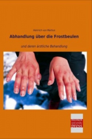 Könyv Abhandlung über die Frostbeulen Heinrich von Martius