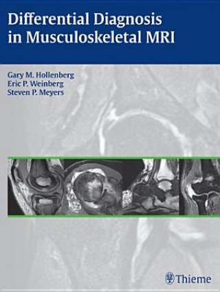 Könyv Differential Diagnosis in Musculoskeletal MR Gary M. Hollenberg
