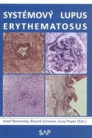 Książka Systémový lupus erythematosus collegium