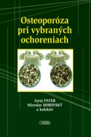 Kniha Osteoporóza pri vybraných ochoreniach Miroslav Borovský a kolektív