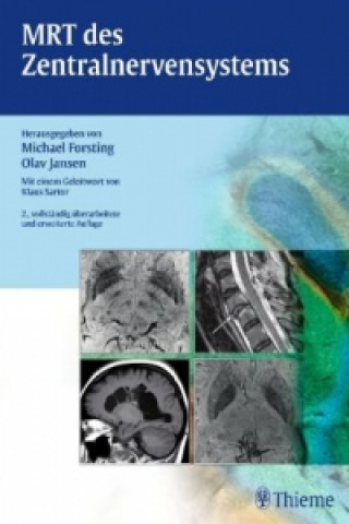 Kniha MRT des Zentralnervensystems Michael Forsting