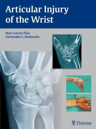 Kniha Articular Injury of the Wrist Marc Garcia-Elias