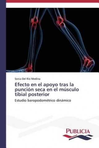 Könyv Efecto en el apoyo tras la puncion seca en el musculo tibial posterior Sonia Del Río Medina