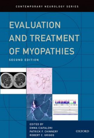 Kniha Evaluation and Treatment of Myopathies Robert Griggs
