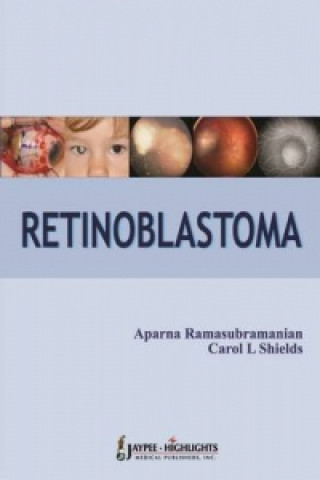 Carte Retinoblastoma Aparna Ramasubramanian