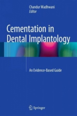 Kniha Cementation in Dental Implantology Chandur Wadhwani