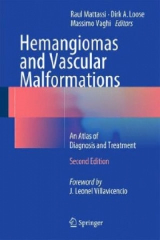 Kniha Hemangiomas and Vascular Malformations Raul Mattassi