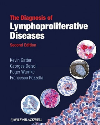 Carte Diagnosis of Lymphoproliferative Diseases 2e Kevin Gatter