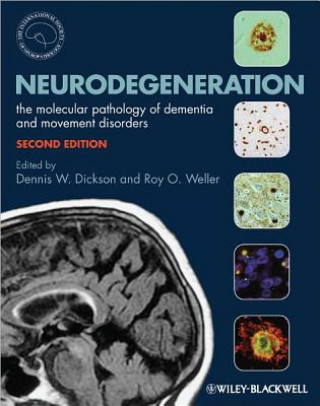 Kniha Neurodegeneration - The Molecular Pathology of Dementia and Movement Disorders 2e Dennis Dickson