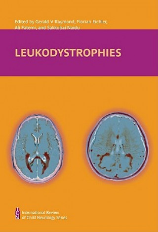 Książka Leukodystrophies Gerald V. Raymond