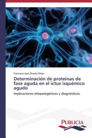 Kniha Determinacion de proteinas de fase aguda en el ictus isquemico agudo Francisco José Álvarez Pérez