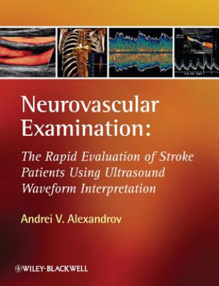 Könyv Neurovascular Examination - The Rapid Evaluation of Stroke Patients Using Ultrasound Waveform Interpretation Andrei V. Alexandrov