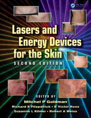 Kniha Lasers and Energy Devices for the Skin Mitchel P. Goldman