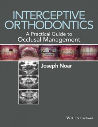 Книга Interceptive Orthodontics - A Practical Guide to Occlusal Management Joseph Noar