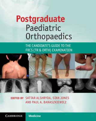 Kniha Postgraduate Paediatric Orthopaedics Sattar Alshryda