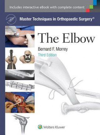 Książka Master Techniques in Orthopaedic Surgery: The Elbow Bernard F Morrey