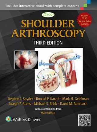 Kniha Shoulder Arthroscopy Stephen J Snyder