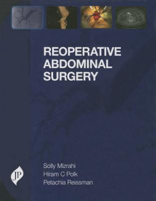 Könyv Reoperative Abdominal Surgery Solly Mizrahi