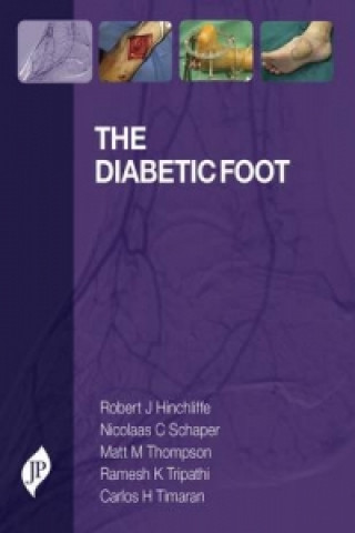 Kniha Diabetic Foot Robert Hinchliffe