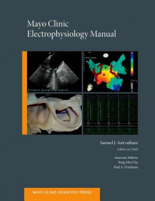 Könyv Mayo Clinic Electrophysiology Manual Samuel J. Asirvatham