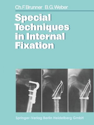 Carte Special Techniques in Internal Fixation C. F. Brunner