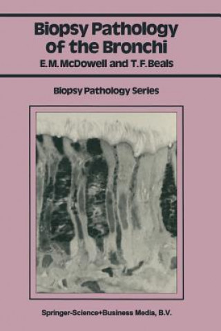 Kniha Biopsy Pathology of the Bronchi Elizabeth M. McDowell