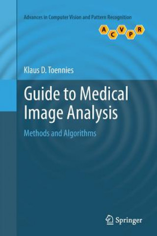 Kniha Guide to Medical Image Analysis Klaus D. Toennies