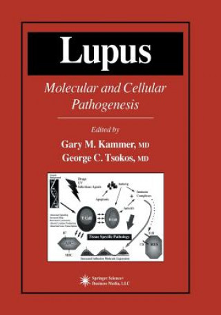 Buch Lupus Gary M. Kammer