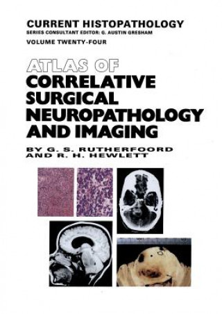 Könyv Atlas of Correlative Surgical Neuropathology and Imaging G.S. Rutherfoord