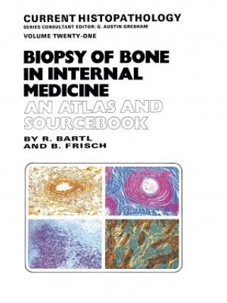 Kniha Biopsy of Bone in Internal Medicine: An Atlas and Sourcebook Reiner Bartl