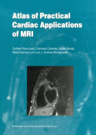 Könyv Atlas of Practical Cardiac Applications of MRI Guillem Pons-Lladó