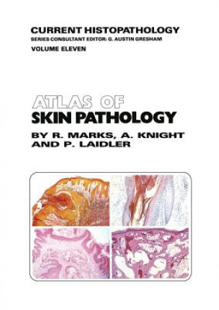 Könyv Atlas of Skin Pathology R.M. Marks