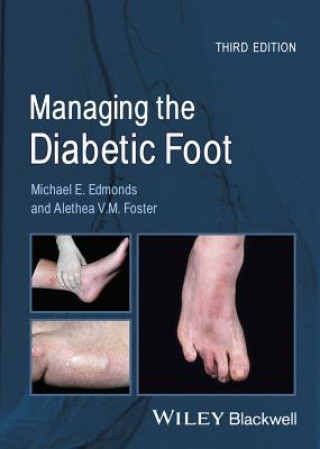 Книга Managing the Diabetic Foot 3e Michael E. Edmonds