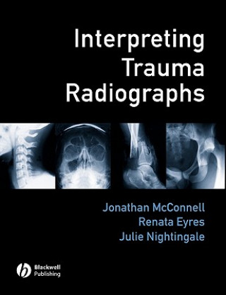 Carte Interpreting Trauma Radiographs Renata Eyres